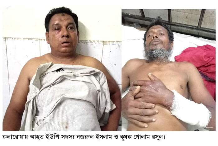 কলারোয়ায় ইউপি সদস্যকে হত্যার চেষ্টা